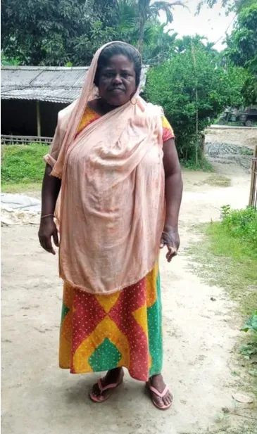 Minara Begum - Surgery, Seizures and Renewed Life